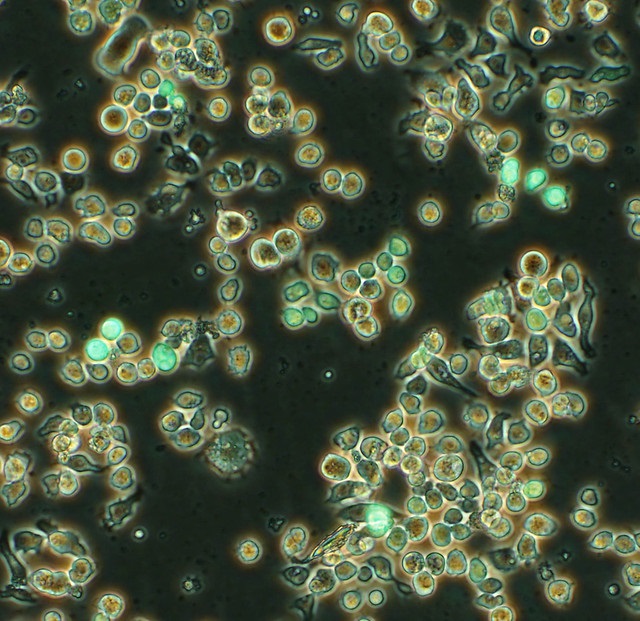 What-is-the-Difference-Between-Transient-and-Stable-Transfection_Figure1.jpg